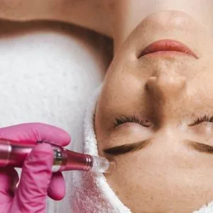 Mezoterapia mikroigłowa twarzy – urządzenie pen, kurs online