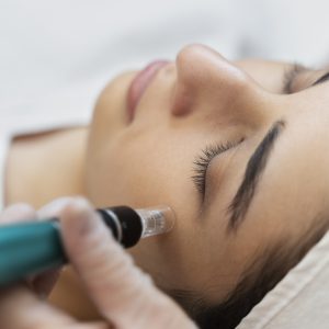 Kurs online mezoterapia mikroigłowa twarzy