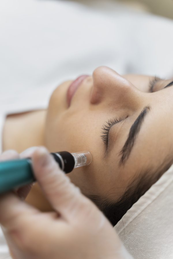 Kurs online mezoterapia mikroigłowa twarzy