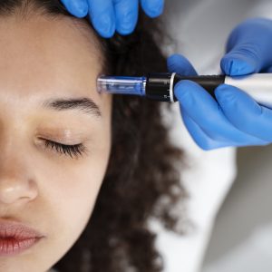 Kurs online mezoterapia mikroigłowa skóry głowy