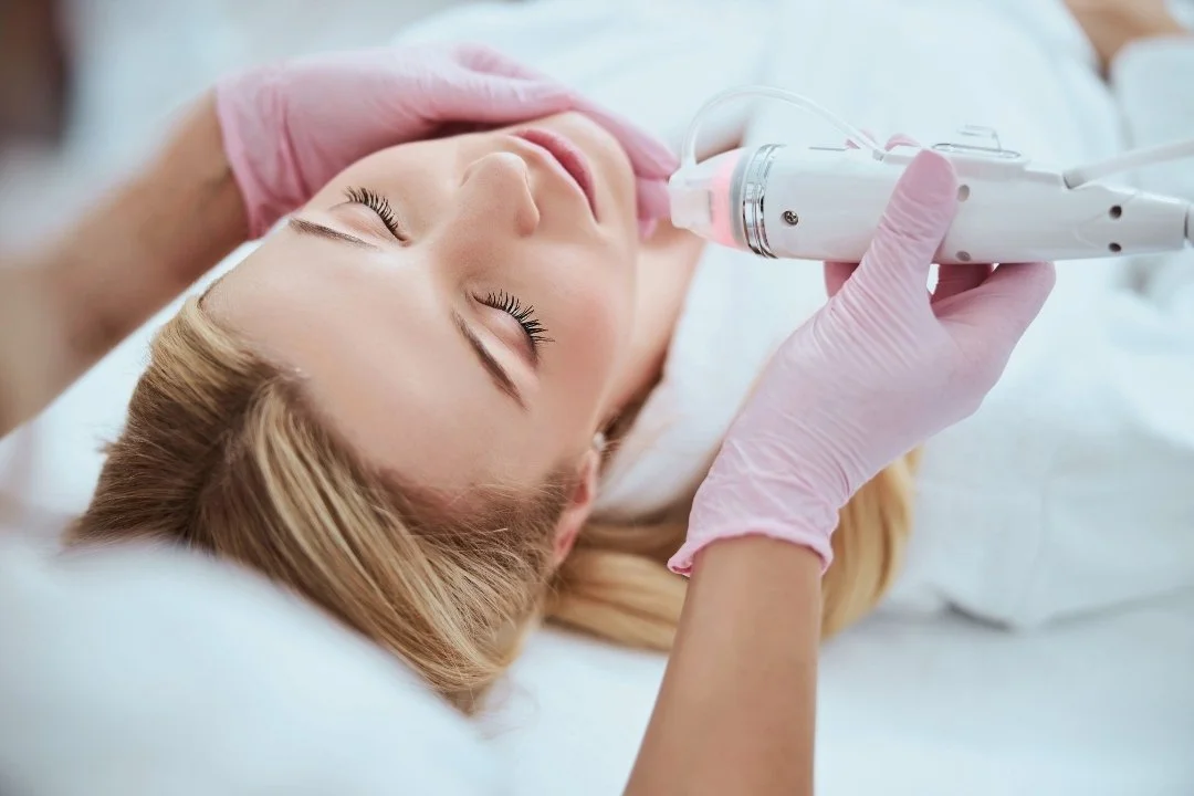 Mezoterapia mikroigłowa - na czym polega i jakie są efekty?